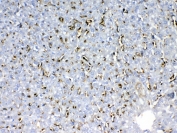 IHC testing of FFPE mouse liver tissue with HBD antibody at 1ug/ml. Required HIER: steam section in pH6 citrate buffer for 20 min and allow to cool prior to testing.