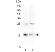 Western blot testing of 1) human HeLa and 2) mouse spleen lysate with TSLP antibody at 0.5ug/ml. Predicted molecular weight ~18 kDa.