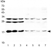 Western blot testing of 1) mouse liver, 2) mouse kidney, 3) mouse testis, 4) rat heart, 5) rat liver, 6) rat kidney and 7) rat testis lysate with TSLP antibody at 0.5ug/ml. Predicted molecular weight ~18 kDa.