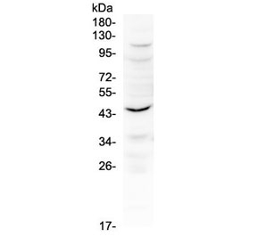 Western blot testing of mouse kidney tissue with Il12 p40 antibody at 0.5ug/ml. Predicted molecular weight 37-40 kDa.