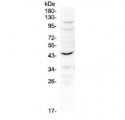 Western blot testing of mouse kidney tissue with Il12 p40 antibody at 0.5ug/ml. Predicted molecular weight 37-40 kDa.