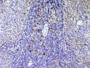 IHC testing of FFPE rat spleen tissue with Il12 p40 antibody at 1ug/ml. Required HIER: steam section in pH6 citrate buffer for 20 min and allow to cool prior to testing.