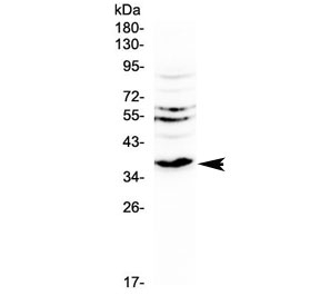 Western blot testing of rat kidney tissue with Il12 p40 antibody at 0.5ug/ml. Predicted molecular weight 37-40 kDa.~