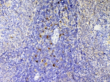 IHC testing of FFPE rat spleen tissue with Il12 p40 antibody at 1ug/ml. Required HIER: steam section in pH6 citrate buffer for 20