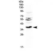 Western blot testing of rat kidney tissue with Il12 p40 antibody at 0.5ug/ml. Predicted molecular weight 37-40 kDa.