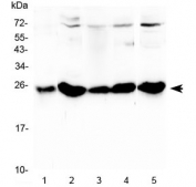 Western blot testing of 1) rat stomach, 2) rat liver, 3) mouse stomach, 4) mouse liver and 5) mouse HEPA1-6 lysate with Plgf antibody at 0.5ug/ml. Predicted molecular weight: ~19 kDa (unmodified), ~28 kDa (glycosylated).