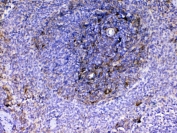 IHC testing of FFPE rat spleen tissue with Vcam-1 antibody at 1ug/ml. Required HIER: steam section in pH6 citrate buffer for 20 min and allow to cool prior to testing.