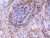 IHC testing of FFPE mouse spleen tissue with Vcam-1 antibody at 1ug/ml. Required HIER: steam section in pH6 citrate buffer for 20 min and allow to cool prior to testing.