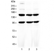 Western blot testing of human 1) HeLa, 2) MCF7 and 3) HepG2 cell lysate with VEGFR3 antibody at 0.5ug/ml. Predicted molecular weight ~153 kDa (long), ~147 kDa (short) and ~93 kDa (sVegfr3).