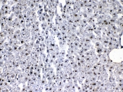 IHC testing of FFPE mouse liver tissue with VEGFR3 antibody at 1ug/ml. Required HIER: steam section in pH6 citrate buffer for 20 min and allow to cool prior to testing.