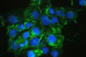 IF/ICC staining of FFPE human A431 cells with VEGFR3 antibody (green) at 2ug/ml and DAPI nuclear stain (blue). HIER: steam section in pH6 citrate buffer for 20 min.