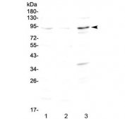 Western blot testing of 1) rat brain, 2) mouse brain and 3) human SK-OV-3 lysate with FOXP2 antibody at 0.5ug/ml. Predicted molecular weight ~80 kDa.