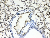 IHC testing of FFPE mouse lung tissue with Periostin antibody at 1ug/ml. Required HIER: steam section in pH6 citrate buffer for 20 min and allow to cool prior to testing.