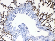 IHC testing of FFPE rat lung tissue with Periostin antibody at 1ug/ml. Required HIER: steam section in pH6 citrate buffer for 20 min and allow to cool prior to testing.