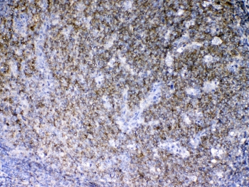 IHC testing of FFPE human tonsil tissue with LYN antibody at 1ug/ml. Required HIER: steam section in pH6 citrate buffer for 20 min and allow to cool prior to testing.