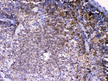 IHC testing of FFPE mouse spleen tissue with LYN antibody at 1ug/ml. Required HIER: steam section in pH6 citrate buffer for 20 min and allow to cool prior to testing.