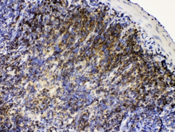 IHC testing of FFPE rat lymph tissue with LYN antibody at 1ug/ml. Required HIER: steam section in pH6 citrate buffer for 20 min and allow to cool prior to testing.