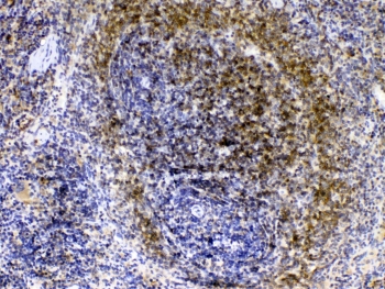 IHC testing of FFPE rat spleen tissue with LYN antibody at 1ug/ml. Required HIER: steam section in pH6 citrate buffer for 20 min and allow to cool prior to testing.