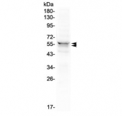 Western blot testing of human 293T cell lysate with LYN antibody at 0.5ug/ml. Predicted molecular weight ~53 kDa (p53lyn), ~56 kDa (p56lyn).