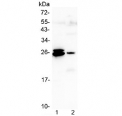 Western blot testing of 1) rat liver and 2) mouse liver lysate with GSTA antibody at 0.5ug/ml. Predicted molecular weight ~25 kDa.