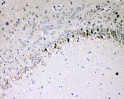 IHC staining of FFPE rat brain with Il-16 antibody at 1ug/ml. HIER: boil tissue sections in pH6, 10mM citrate buffer, for 10-20 min followed by cooling at RT for 20 min.
