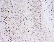IHC staining of FFPE mouse brain with Il-16 antibody at 1ug/ml. HIER: boil tissue sections in pH6, 10mM citrate buffer, for 10-20 min followed by cooling at RT for 20 min.