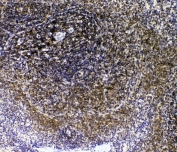 IHC staining of FFPE rat spleen with Il-16 antibody at 1ug/ml. HIER: boil tissue sections in pH6, 10mM citrate buffer, for 10-20 min followed by cooling at RT for 20 min.