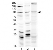 Western blot testing of 1) rat brain, 2) mouse brain and 3) human U-87MG lysate with Semaphorin 3A antibody at 0.5ug/ml. Predicted molecular weight ~89 kDa.