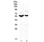 Western blot testing of human 1) HeLa and 2) HepG2 cell lysate with KPNA2 antibody at 0.5ug/ml. Predicted molecular weight: ~58 kDa.