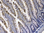 IHC testing of FFPE rat intestine tissue with Xanthine Oxidase antibody at 1ug/ml. Required HIER: steam section in pH6 citrate buffer for 20 min and allow to cool prior to testing.