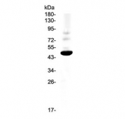 Western blot testing of rat PC-12 cell lysate with CCR1 antibody at 0.5ug/ml. Predicted molecular weight 40-45 kDa.