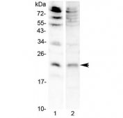 Western blot testing of 1) mouse brain and 2) rat RH35 lysate with FGF7 antibody at 0.5ug/ml. Predicted molecular weight ~22 kDa.