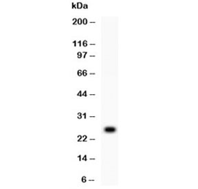 Western blot testing of 1ng of recombinant human protein with TREM1 antibody at 0.5ug/ml.~