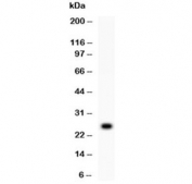 Western blot testing of 1ng of recombinant human protein with TREM1 antibody at 0.5ug/ml.