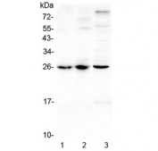 Western blot testing of 1) mouse lung, 2) mouse spleen and 3) rat spleen lysate with Trem1 antibody at 0.5ug/ml. Predicted molecular weight: 26-30 kDa depending on glycosylation level.