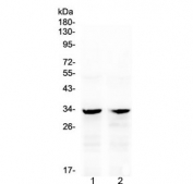 Western blot testing of 1) rat kidney and 2) mouse kidney with Caspase-6 antibody at 0.5ug/ml. Predicted molecular weight ~33 kDa (precursor).