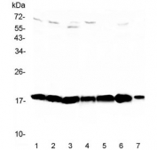 Western blot testing of 1) rat testis, 2) rat brain, 3) rat thymus, 4) mouse testis, 5) mouse brain, 6) mouse thymus and 7) mouse HEPA1-6 lysate with WFDC2 antibody at 0.5ug/ml. Expected molecular weight: 13-25 kDa, depending on glycosylation level.