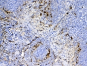 IHC testing of FFPE mouse spleen tissue with CD105 antibody at 1ug/ml. Required HIER: steam section in pH6 citrate buffer for 20 min and allow to cool prior to testing.