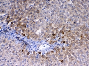 IHC testing of FFPE rat liver tissue with CD105 antibody at 1ug/ml. Required HIER: steam section in pH6 citrate buffer for 20 min and allow to cool prior to testing.