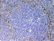 IHC testing of FFPE rat spleen tissue with CD105 antibody at 1ug/ml. Required HIER: steam section in pH6 citrate buffer for 20 min and allow to cool prior to testing.