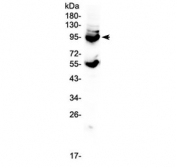 Western blot testing of mouse lung tissue lysate with CD105 antibody at 0.5ug/ml. Expected molecular weight: 70/90 kDa (monomer, unmodified/glycosylated); 140-180 kDa (dimer, unmodified/glycosylated).