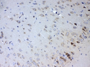 IHC testing of FFPE rat brain tissue with IL15RA antibody at 1ug/ml. Required HIER: steam section in pH6 citrate buffer for 20 min and allow to cool prior to testing.