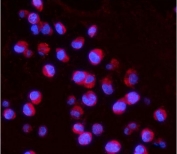 Immunofluorescent staining of FFPE human K562 cells with IL15RA antibody (red) and DAPI nuclear stain (blue). HIER: steam section in pH6 citrate buffer for 20 min.