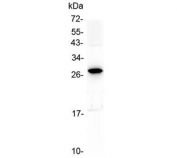 Western blot testing of human placental tissue with IL15RA antibody at 0.5ug/ml. Predicted molecular weight ~28 kDa.