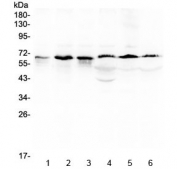 Western blot testing of 1) rat ovary, 2) mouse testis, 3) mouse thymus, 4) human MCF7, 5) human A549 and 6) human HeLa lysate with TRAF5 antibody at 0.5ug/ml. Expected molecular weight ~64 kDa.