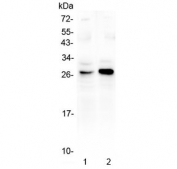 Western blot testing of 1) rat kidney and 2) mouse kidney using GITR antibody at 0.5ug/ml. Predicted molecular weight ~26 kDa.