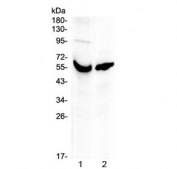 Western blot testing of human 1) placenta and 2) A431 lysate with VDBP antibody at 0.5ug/ml. Predicted molecular weight ~53 kDa.