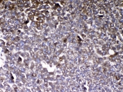 IHC testing of FFPE mouse liver tissue with VDBP antibody at 1ug/ml. Required HIER: steam section in pH6 citrate buffer for 20 min and allow to cool prior to testing.