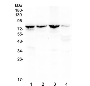 Western blot testing of 1) rat kidney, 2) mouse kidney, 3) mouse lung and 4) human MCF7 lysate with Calpain 2 antibody at 0.5ug/ml. Predicted molecular weight ~80 kDa.