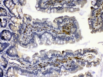 IHC testing of FFPE rat small intestine tissue with Calpain 2 antibody at 1ug/ml. Required HIER: steam section in pH6 citrate buffer for 20 min and allow to cool prior to testing.
